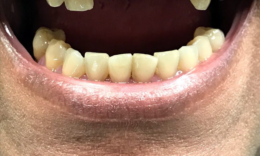 Sasha Winderbaum DDS